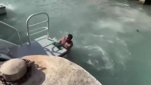 Dude Lost Part Of His Leg After Swimming On A Yacht