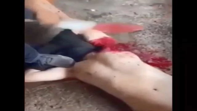 Dude Gets Chopped Into Pieces