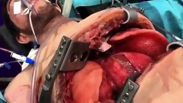 What Surgery Is This?