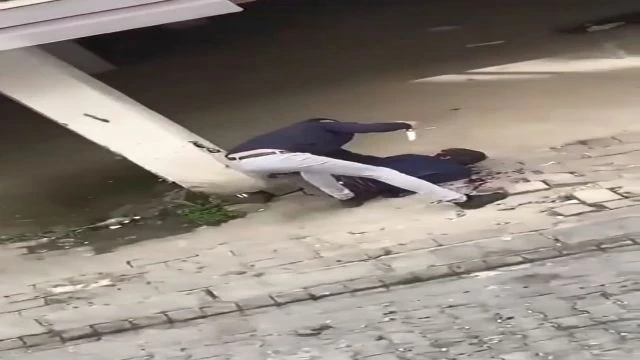 Man Brutally Stabbed On Face By Psycho Guy