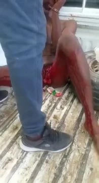 Rapist With A Cut Off Penis...he Will Probably End Up Killed