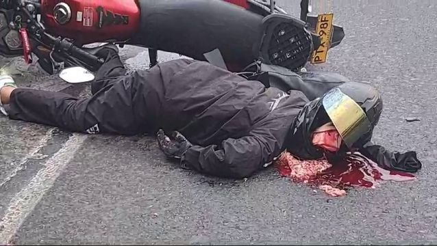 The Helmet Did Not Save The Motorcyclist's Head From Destruction