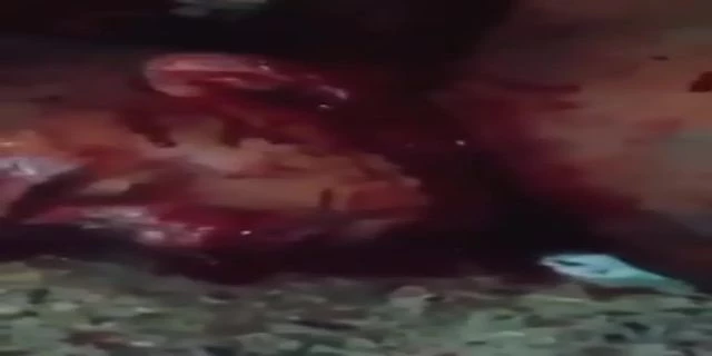 Beheading Of A Man With His Throat Cut