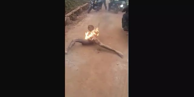 Torched African Thief Squirms In Pain With His Hands Tied