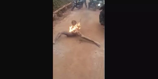 Torched African Thief Squirms In Pain With His Hands Tied