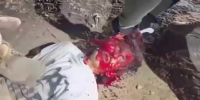 The Skin Is Cut Off From The Man's Face Alive