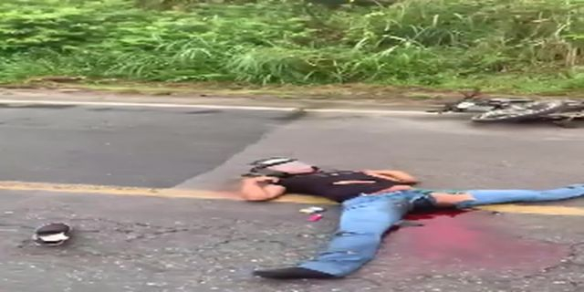 A Dead Motorcyclist With A Good Leg Stretch