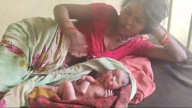 A Child With 4 Arms And 4 Legs Was Born In India