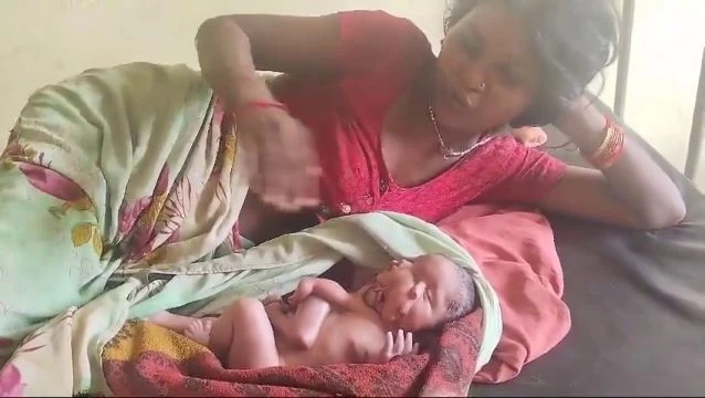 A Child With 4 Arms And 4 Legs Was Born In India