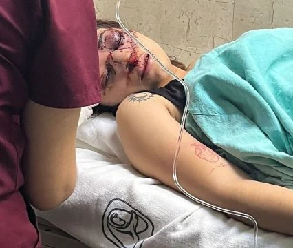 Girl In Critical Condition After Getting Beaten By Her Boyfriend During Halloween Party In Mexico