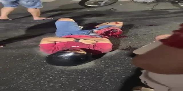 Biker's Leg Got Fucked Up